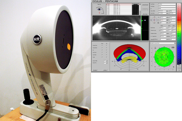 写真：ペンタカムHR (前眼部三次元解析)