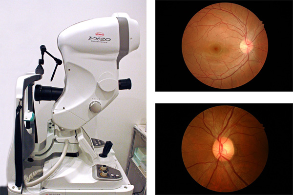 写真：眼底カメラ