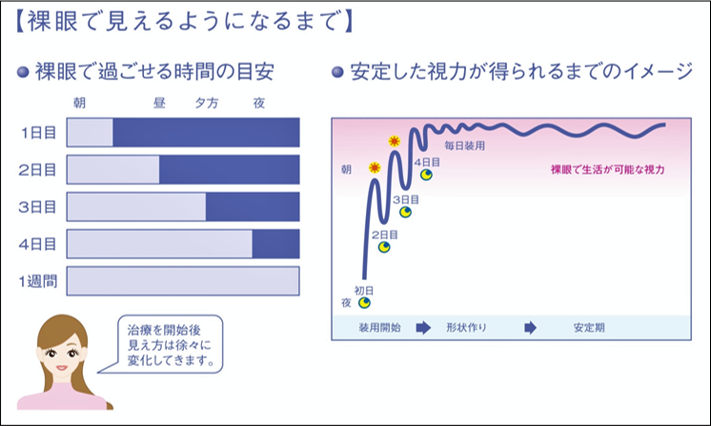 デメリット