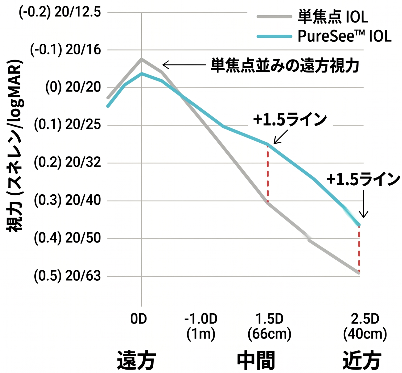 6ヶ月時点の単眼焦点深度 グラフ